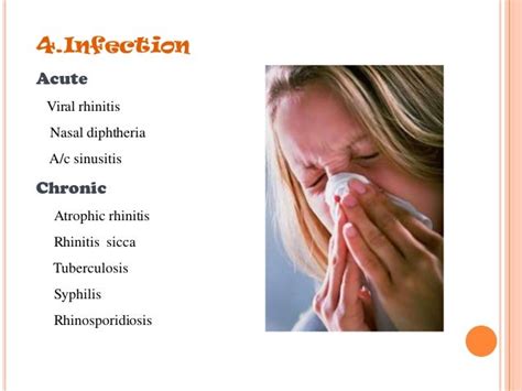 Epistaxis Management