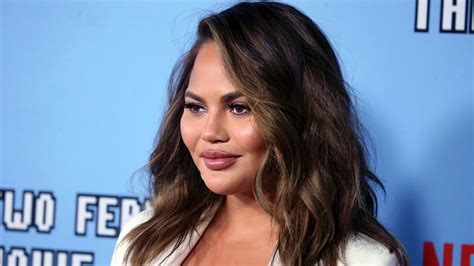 Chrissy Teigen Shares Nude Selfie Of Her Surgical Scars ‘love Yourself Access