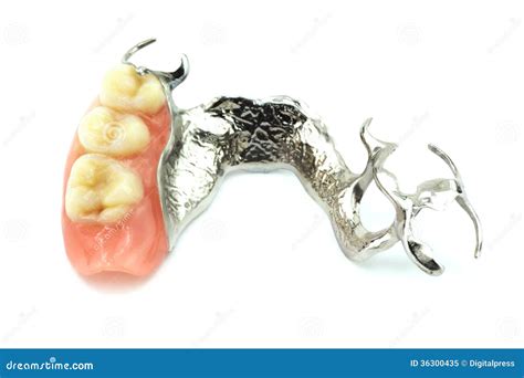A Partial Denture Mounted On A Plaster Study Model Royalty Free Stock