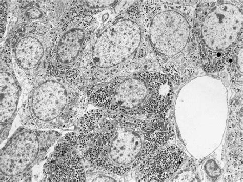 Electron Micrograph Of Anterior Pituitary Cells Diagram Quizlet