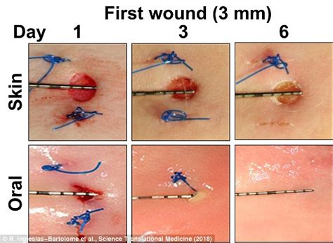 Tanning, burning, and peeling is how the body acts to protect the skin and repair the damage. Why cuts in your mouth heal faster | Daily Mail Online