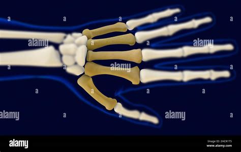 Huesos Metacarpianos De La Mano Anatomía Del Concepto Médico 3d