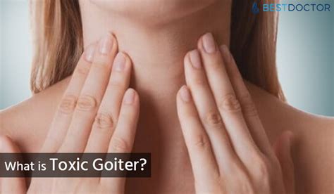 Toxic Goiter Causes Symptoms And Treatment