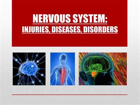 Ppt Nervous System Injuries Diseases Disorders Powerpoint