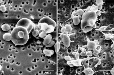 Scanning Electron Micrograph Of Red Blood Cells And Platelets From Download Scientific Diagram
