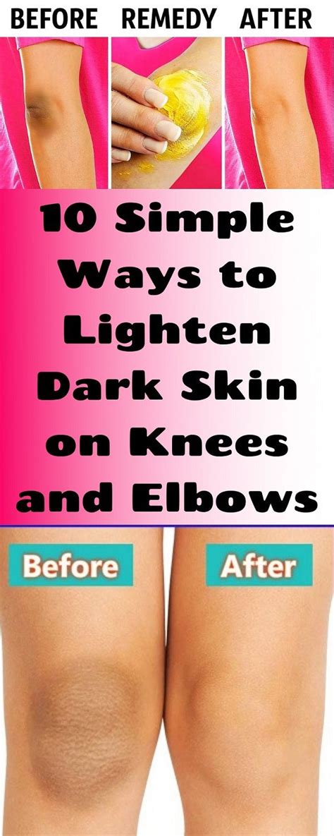 How To Lighten Skin On Elbows And Knees Resipes My Familly