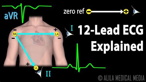 12 Lead Ecg Explained Animation Ekg Interpretation Ecg