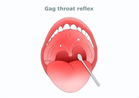 Having Gag Reflex Gag Reflex Is A Contraction Of The Back Of The