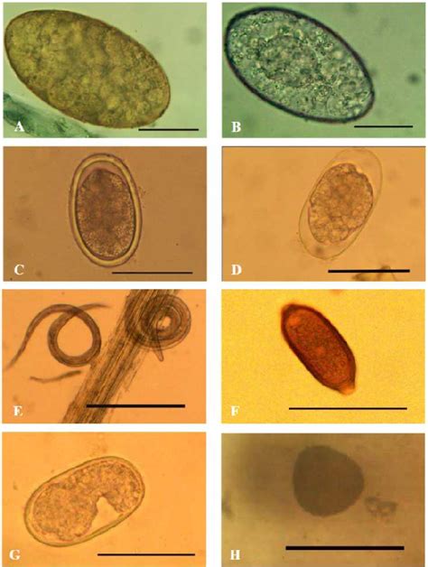 Figure 4 From Gastrointestinal Parasites Of Cattle In Central Java