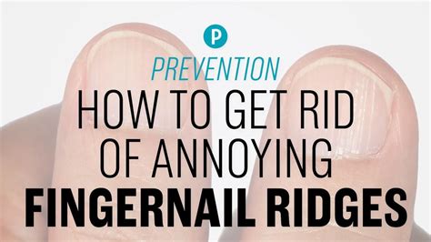 Doctors Reveal How To Get Rid Of Those Annoying Ridges In Your