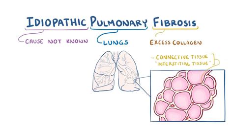 Idiopathic Pulmonary Fibrosis Video And Anatomy Osmosis