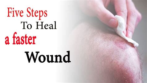 How To Heal Your Wound Heal Info