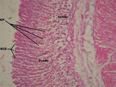 Stomach Histology Parietal Cells