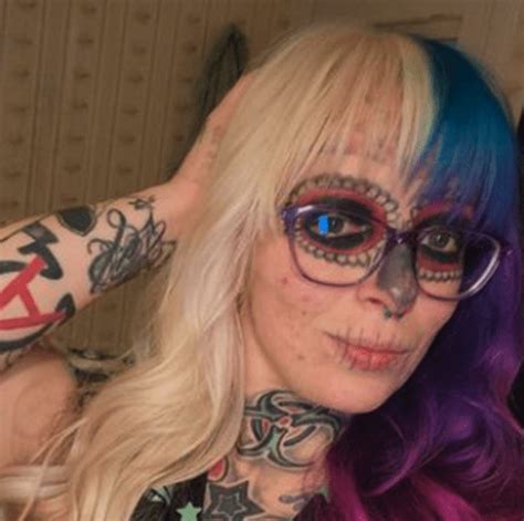 Alyssa Zebraskys Face Tattoo Removal Journey Removery