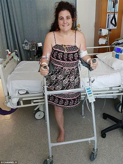 Australians Leg Amputated After Thailand Scooter Crash Daily Mail Online