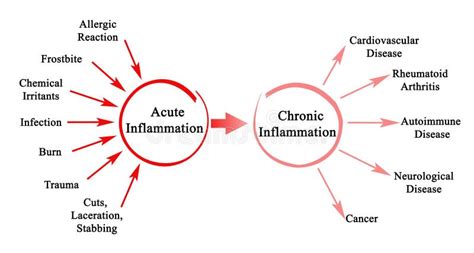 Inflammation Stock Illustrations 50641 Inflammation Stock