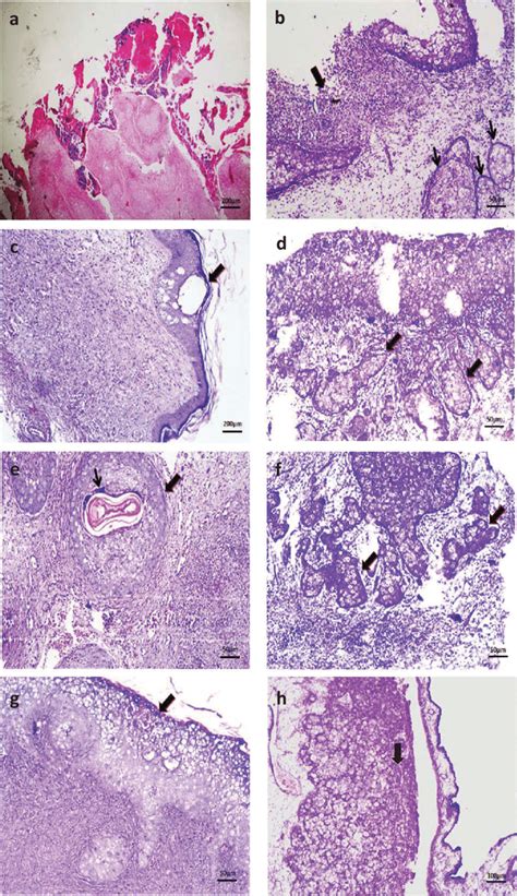 Histopathological Lesions Of Apv Infection In Different Tissuesa