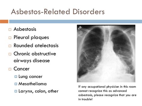 Lung Disease Asbestos