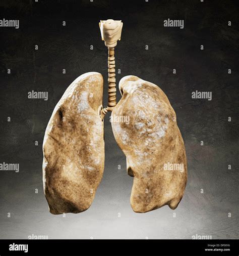 Polmoni Dei Fumatori Immagini E Fotografie Stock Ad Alta Risoluzione