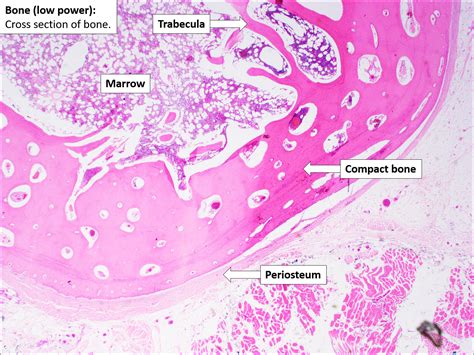 Bone Normal Histology Nus Pathweb Nus Pathweb