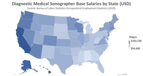 Become A Diagnostic Medical Sonographer In 2020