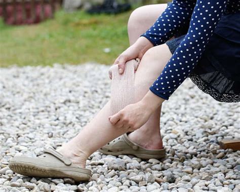 Chronic Venous Insufficiency Treatment How To Get Rid Of Leg Pain Vein Center In Walnut Creek
