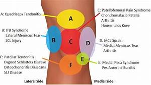 Outer Knee Location Chart