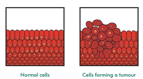 What Is Cancer Understanding Macmillan Cancer Support