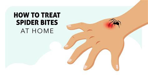 How To Treat Spider Bites At Home Insight Pest Control