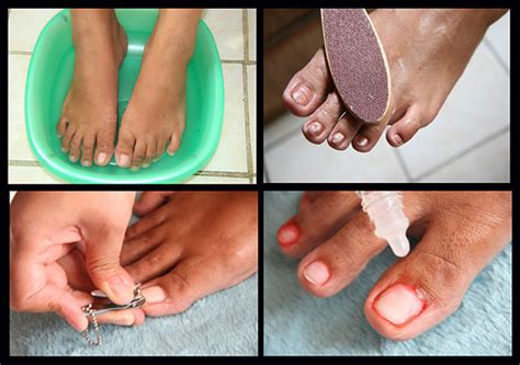How To Care For Your Feet And Toenails Blog