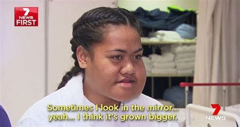 Tongan Girl Undergoes Radical Surgery In Melbourne To Remove Enormous