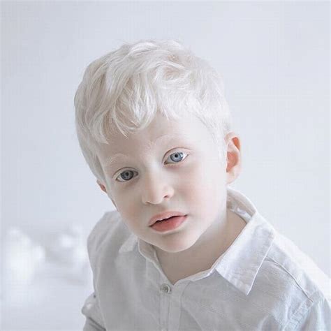 Stunning Portraits Showing Albinism S Beauty