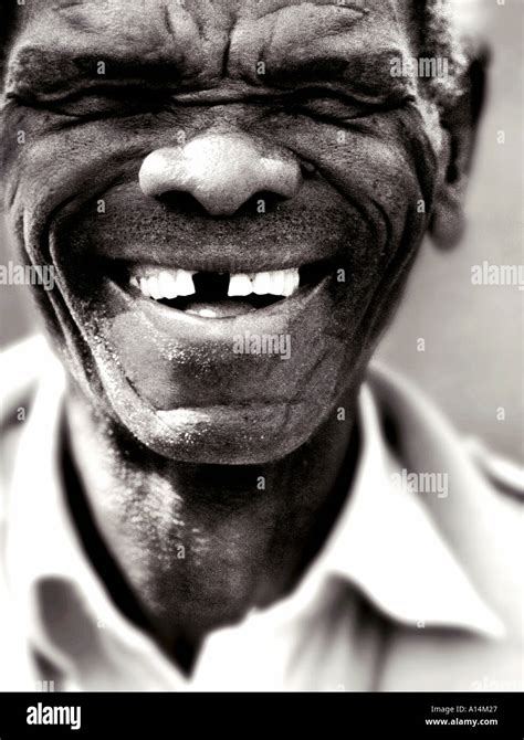 African Missing Teeth Hi Res Stock Photography And Images Alamy