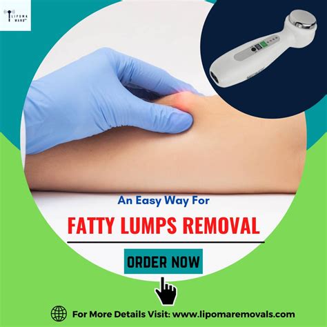 Check Out Our Fatty Lumps Removals Treatment Option With L Flickr