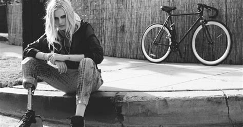 This Model Lost Her Leg To Toxic Shock Syndrome Now She Has A Warning