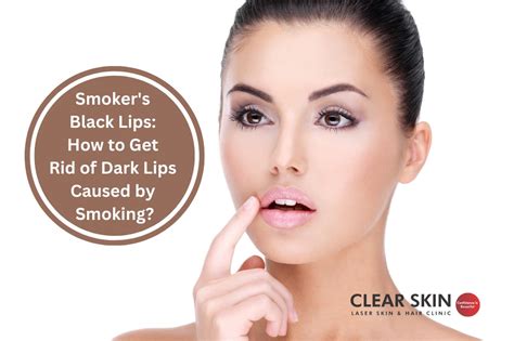 Smokers Black Lips How To Get Rid Of Dark Lips Caused By Smoking