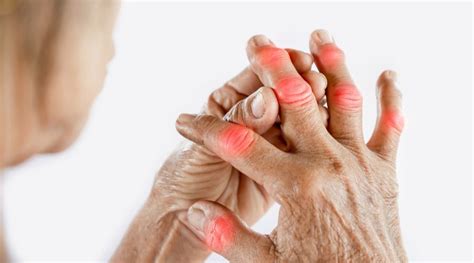 What Helps Joint Pain In Cold Weather Fox Chiropractic