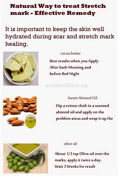 Home Remedies For Stretch Marks That Work Surprisingly Well Iamjeni