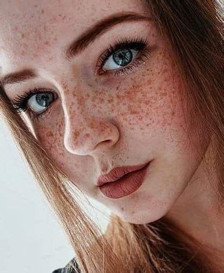 Who Else Finds Freckles Attractive Freckles Girl Beautiful Freckles Red Hair Freckles