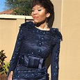 Leleti Khumalo talks about how she learned to accept her skin condition