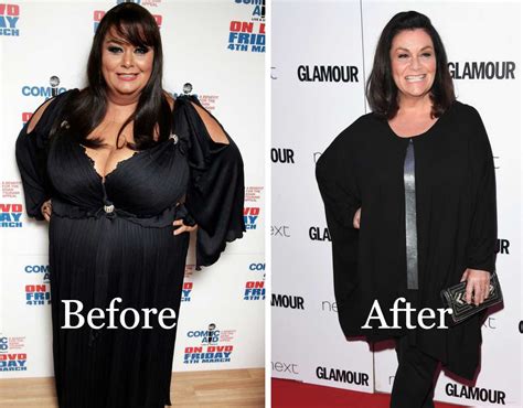 Dawn French Weight Loss 2024 Diet Workout Before After