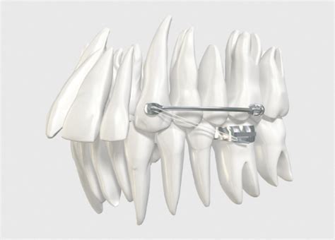 Carriere Motion 3d World Class Orthodontics Ortho Organizers Gmbh