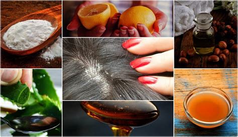 10 Effective Home Remedies For Dandruff Best Herbal Health
