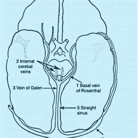 The Mechanism Of Subdural Haemorrhage The Bridging Veins Travel From