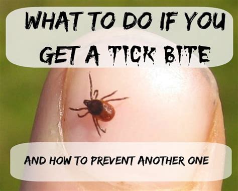Extracting Ticks And Preventing Tick Bites Jeffrey Sterling Md