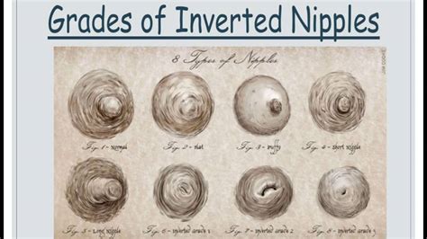 Of Females And Of Males Have A Third Nipple The Fact Base