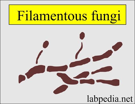 Fungal Infections Diagnosis And Treatment