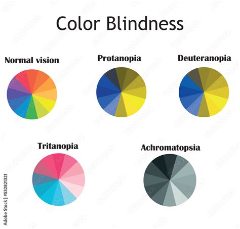 Color Blindness Typs Normal Vision Protanopia Deuteranopia Tritanopia And Achromatopsia