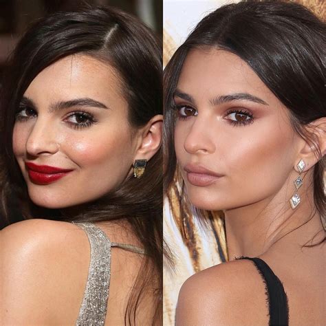 Emily Ratajkowski Before And After Plastic Surgery 01 Celebrity Hot