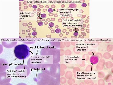 Haematology In A Nutshell Small Lymphocytes